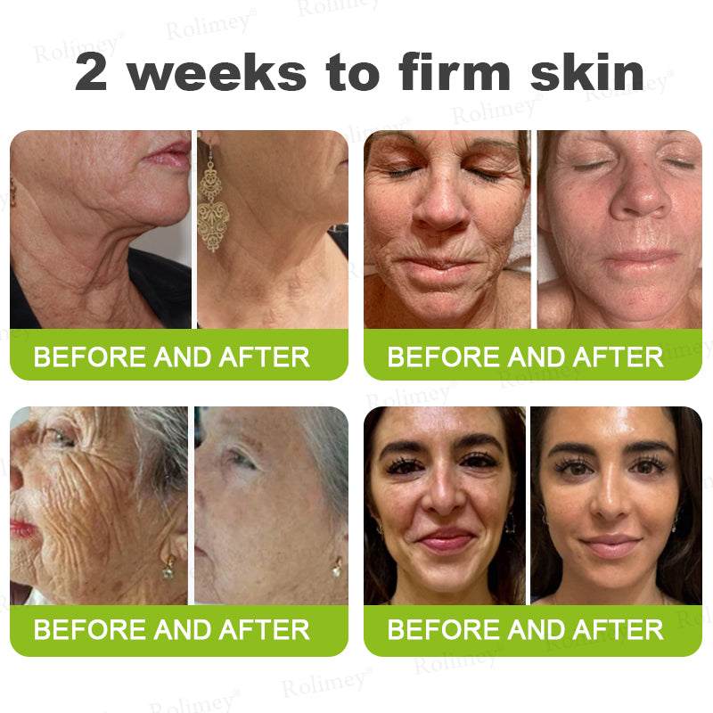 ⌛💫🪄Made and shipped from Australia 💫Rolimey® Botox & Vita-A Retinol Shot Wrinkle-Lift Tightening cream - Last Day Promotion 70% OFF
