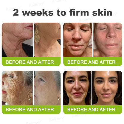 ⌛💫🪄Made and shipped from Australia 💫Rolimey® Botox & Vita-A Retinol Shot Wrinkle-Lift Tightening cream - Last Day Promotion 70% OFF