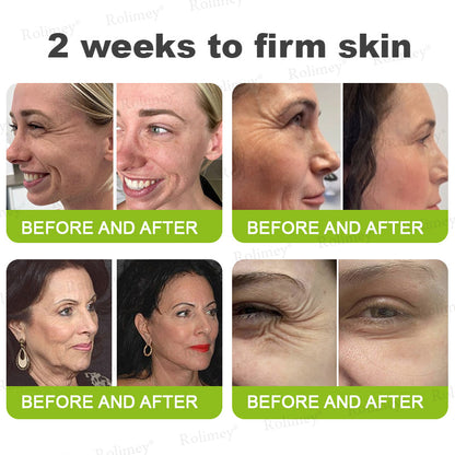 👨‍⚕️Made and shipped from the Australia💫Rolimey® Botox & Vita-A Retinol Shot Wrinkle-Lift Tightening stick- Last Day Promotion 70% OFF