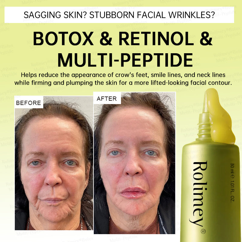 🪄🌟Rolimey® Multi-Peptide Retinol Shot Age-Reset Wrinkle-Lift Cream