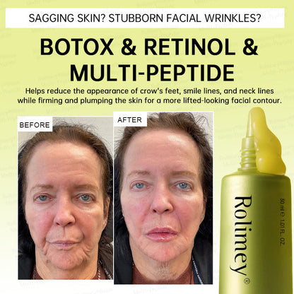 🪄🌟Rolimey® Multi-Peptide Retinol Shot Age-Reset Wrinkle-Lift Cream