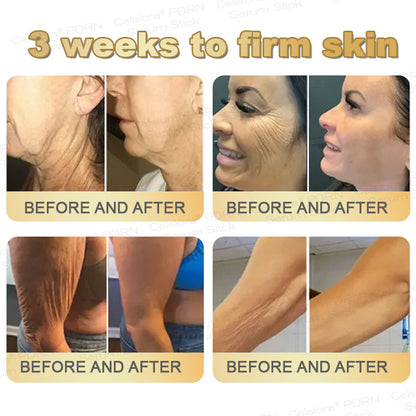 🌟✨Celsiora® PDRN Multi-Peptide Firming Serum Stick👩‍🔬LAST DAY 70% OFF