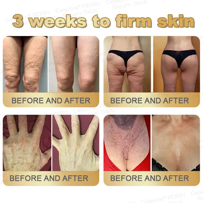 🌟✨Celsiora® PDRN Multi-Peptide Firming Serum Stick👩‍🔬LAST DAY 70% OFF