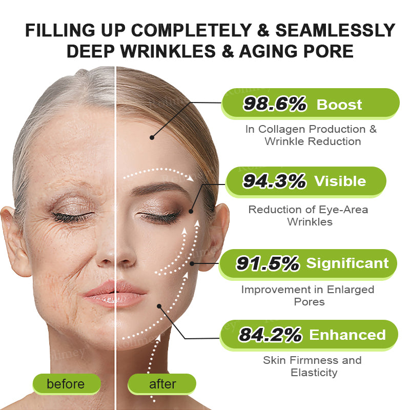 ⌛💫🪄Made and shipped from Australia 💫Rolimey® Botox & Vita-A Retinol Shot Wrinkle-Lift Tightening cream - Last Day Promotion 70% OFF