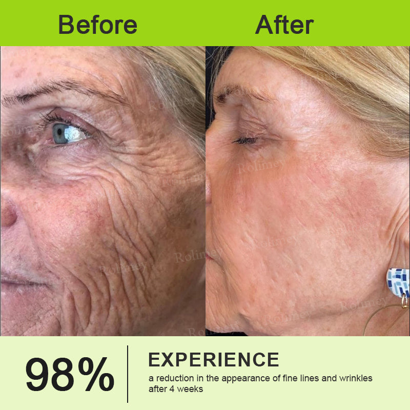 👨‍⚕️Made and shipped from the Australia💫Rolimey® Botox & Vita-A Retinol Shot Wrinkle-Lift Tightening stick- Last Day Promotion 70% OFF