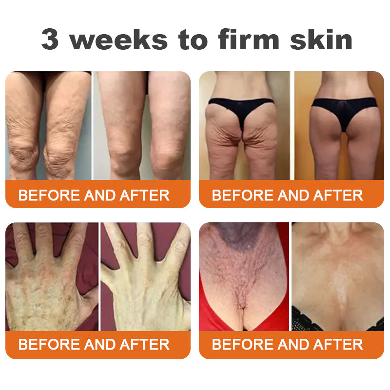 ✨✨LAST DAY 70% OFF🌟Flysmus™ Botox Bee Venom Firming Serum Stick🔥Made and Shipped from Australia
