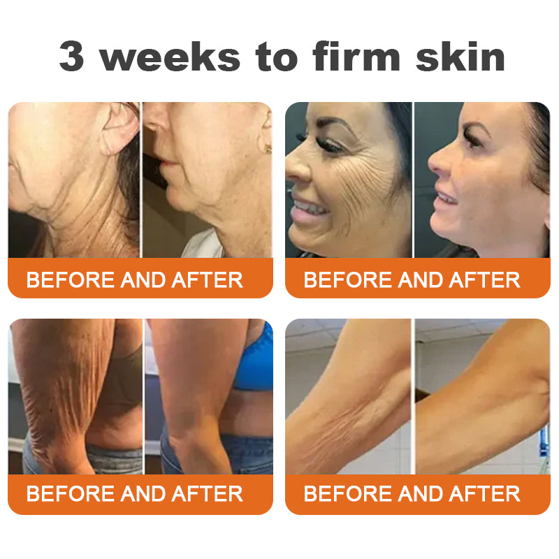 ✨✨LAST DAY 70% OFF🌟Flysmus™ Botox Bee Venom Firming Serum Stick🔥Made and Shipped from Australia