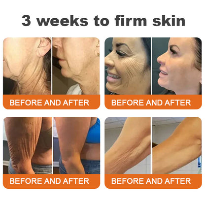 ✨✨LAST DAY 70% OFF🌟Flysmus™ Botox Bee Venom Firming Serum Stick🔥Made and Shipped from Australia