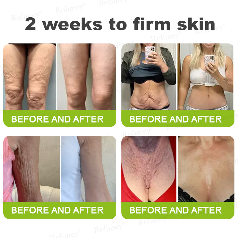 ⌛💫🪄Made and shipped from Australia 💫Rolimey® Botox & Vita-A Retinol Shot Wrinkle-Lift Tightening cream - Last Day Promotion 70% OFF