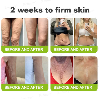 ⌛💫🪄Made and shipped from Australia 💫Rolimey® Botox & Vita-A Retinol Shot Wrinkle-Lift Tightening cream - Last Day Promotion 70% OFF