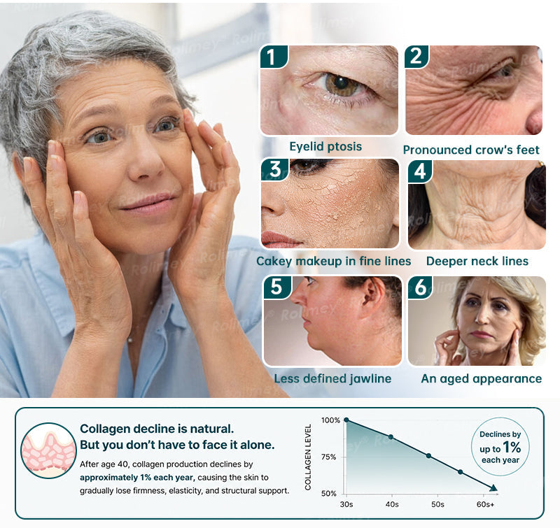 ⏰🔥🇦🇺 LAST DAY!🌟✨Rolimey® Botox & Stem Cell Wrinkle-Lift Tightening Cream