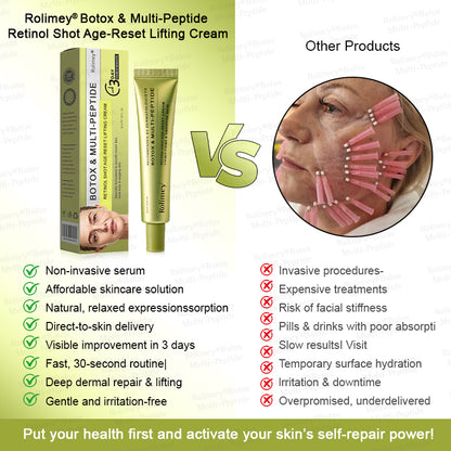 🪄🌟Rolimey® Multi-Peptide Retinol Shot Age-Reset Wrinkle-Lift Cream