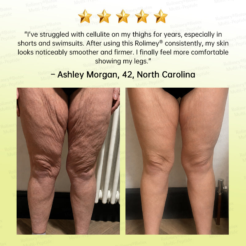 🪄🌟Rolimey® Multi-Peptide Retinol Shot Age-Reset Wrinkle-Lift Cream