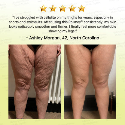 🪄🌟Rolimey® Multi-Peptide Retinol Shot Age-Reset Wrinkle-Lift Cream