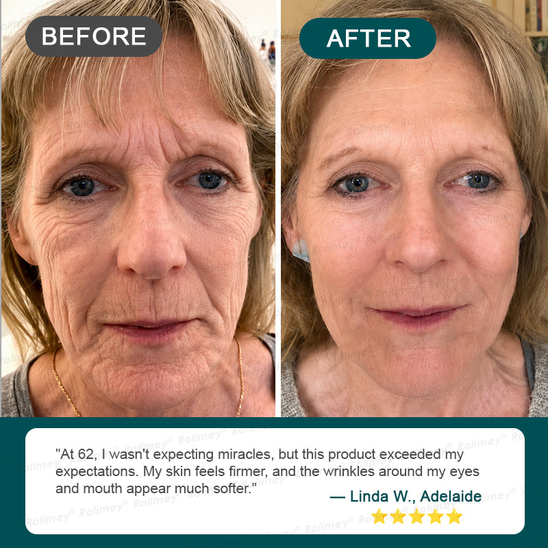 ⏰🔥🇦🇺 LAST DAY!🌟✨Rolimey® Botox & Stem Cell Wrinkle-Lift Tightening Cream