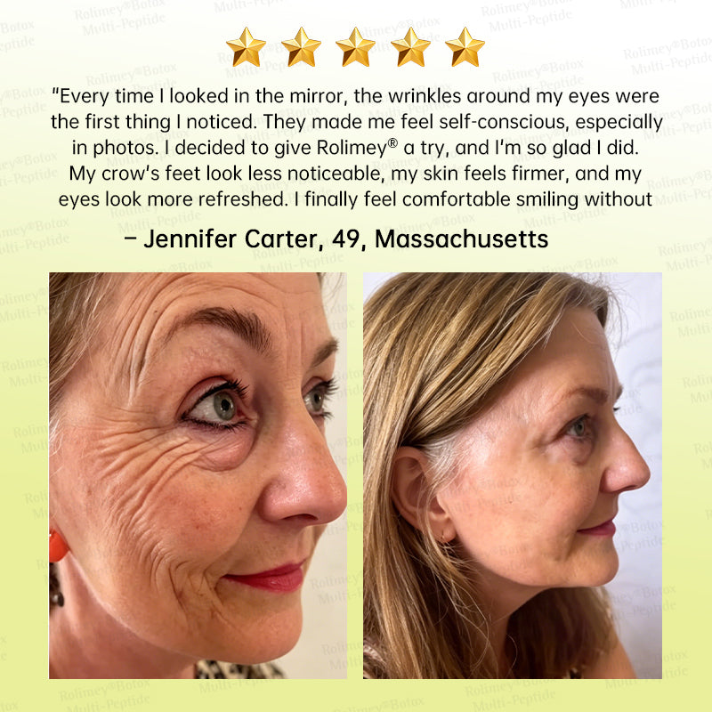 🪄🌟Rolimey® Multi-Peptide Retinol Shot Age-Reset Wrinkle-Lift Cream