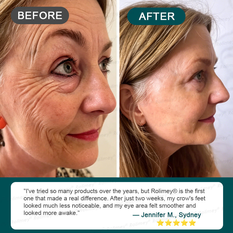 ⏰🔥🇦🇺 LAST DAY!🌟✨Rolimey® Botox & Stem Cell Wrinkle-Lift Tightening Cream