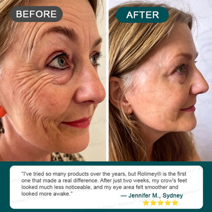 ⏰🔥🇦🇺 LAST DAY!🌟✨Rolimey® Botox & Stem Cell Wrinkle-Lift Tightening Cream