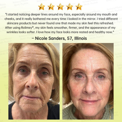 🪄🌟Rolimey® Multi-Peptide Retinol Shot Age-Reset Wrinkle-Lift Cream