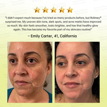 🪄🌟Rolimey® Multi-Peptide Retinol Shot Age-Reset Wrinkle-Lift Cream