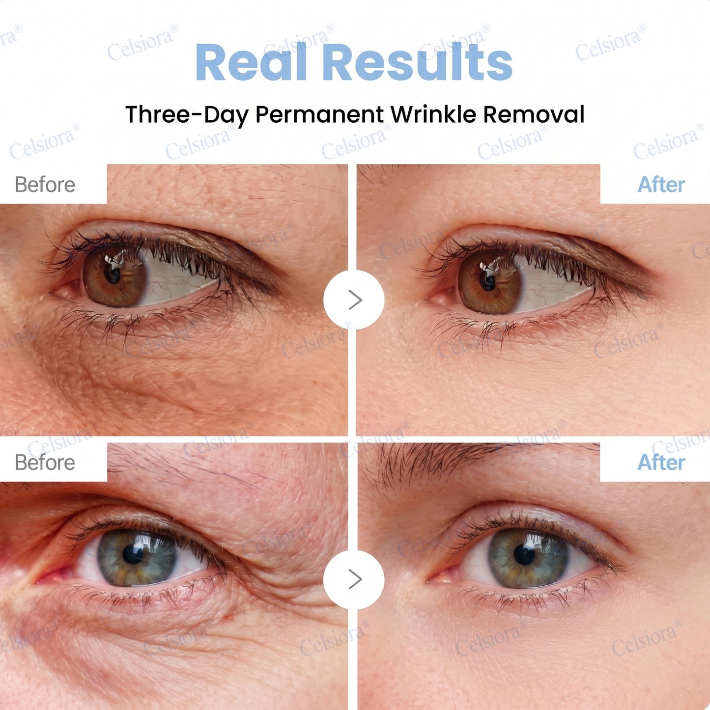 🌿🌟✨Celsiora® PDRN Anti-Wrinkle Shot – Lift & Firming Cream