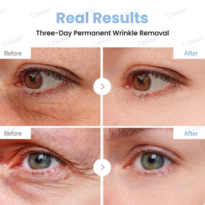 🌿🌟✨Celsiora® PDRN Anti-Wrinkle Shot – Lift & Firming Cream