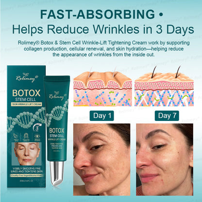 ⏰🔥🇦🇺 LAST DAY!🌟✨Rolimey® Botox & Stem Cell Wrinkle-Lift Tightening Cream