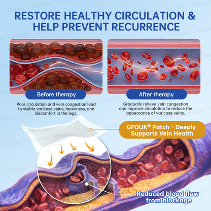 ✅GFOUK® VeinRelief Microneedle Patch ⚡Instant Relief, Long-Term Results