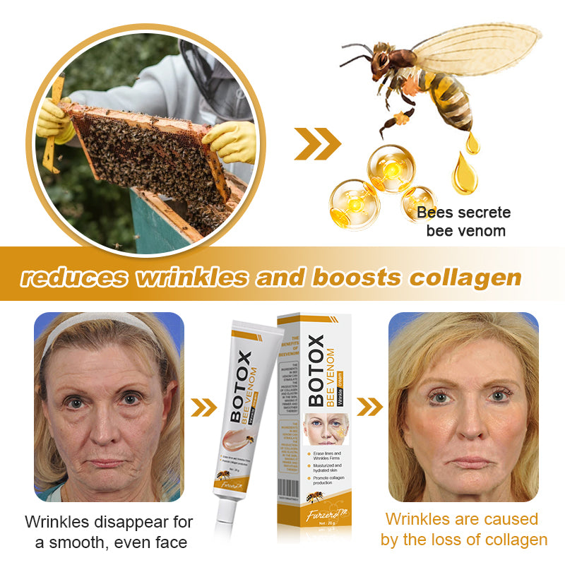 Made and Shipped from Australia-Furzero™ Botox Bee Venom Wrinkle Removal Cream- LAST DAY 70% OFF