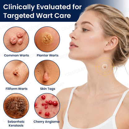 🎊✨GFOUK® 7-Day MicroNeedle Wart & Skin Tag Removal Patch