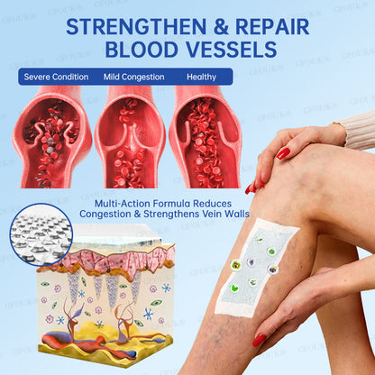 ✅GFOUK® VeinRelief Microneedle Patch ⚡Instant Relief, Long-Term Results