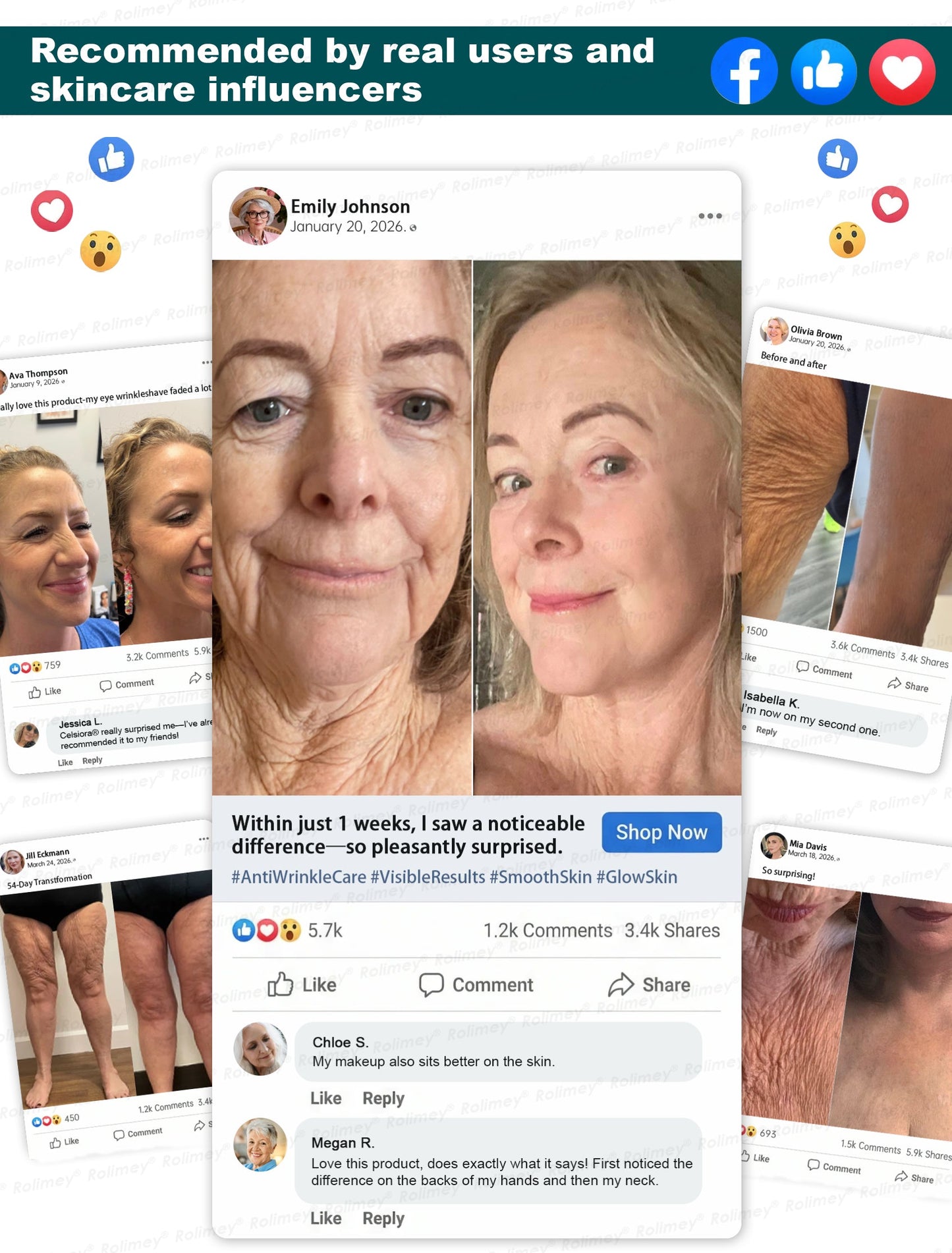 ⏰🔥🇦🇺 LAST DAY!🌟✨Rolimey® Botox & Stem Cell Wrinkle-Lift Tightening Cream
