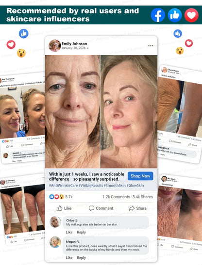 ⏰🔥🇦🇺 LAST DAY!🌟✨Rolimey® Botox & Stem Cell Wrinkle-Lift Tightening Cream
