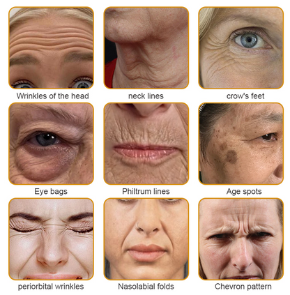 Made and Shipped from Australia-Furzero™ Botox Bee Venom Wrinkle Removal Cream- LAST DAY 70% OFF