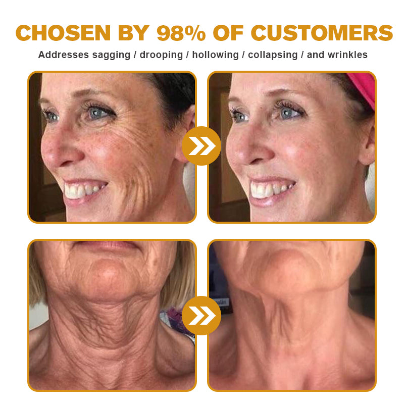 Made and Shipped from Australia-Furzero™ Botox Bee Venom Wrinkle Removal Cream- LAST DAY 70% OFF