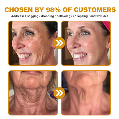 Made and Shipped from Australia-Furzero™ Botox Bee Venom Wrinkle Removal Cream- LAST DAY 70% OFF