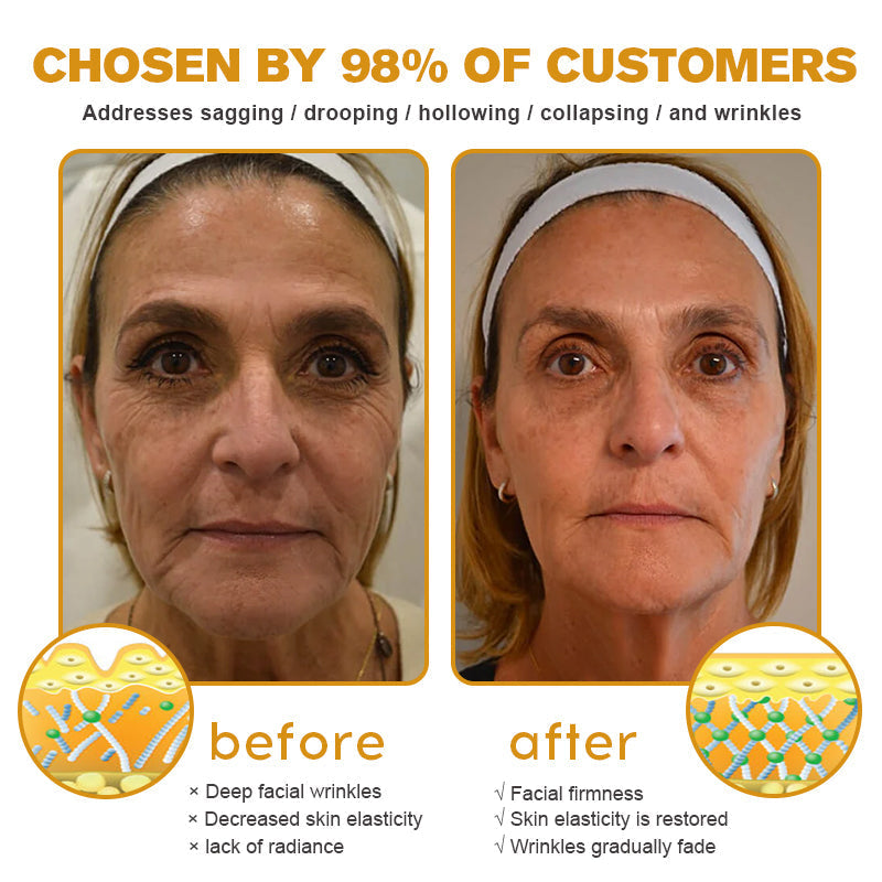 Made and Shipped from Australia-Furzero™ Botox Bee Venom Wrinkle Removal Cream- LAST DAY 70% OFF